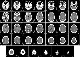 CT Scan Image - Deep Medical Centre