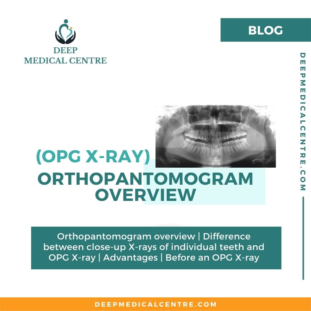 Orthopantomogram overview