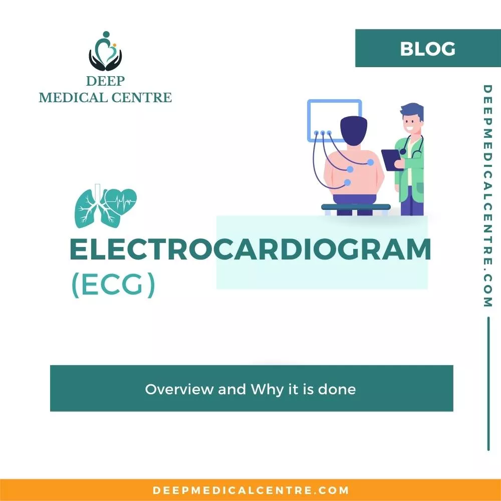 ECG Overview