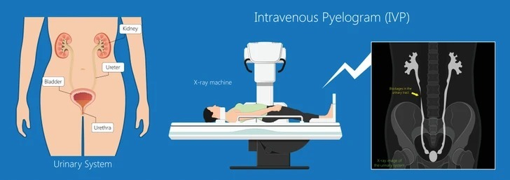 IVP Overview - IVP Procedure