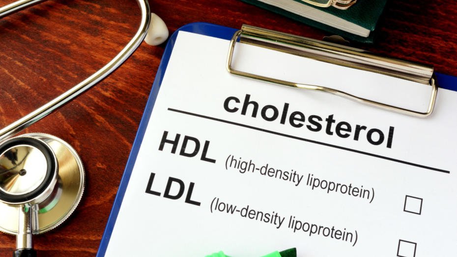 Medical Test Every Year: No. 2- Cholesterol