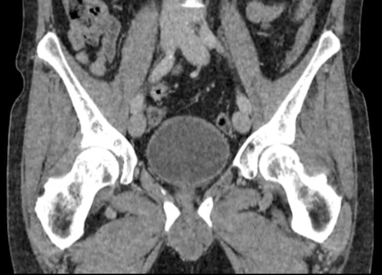 11 Types Of CT Scans Deep Medical Centre