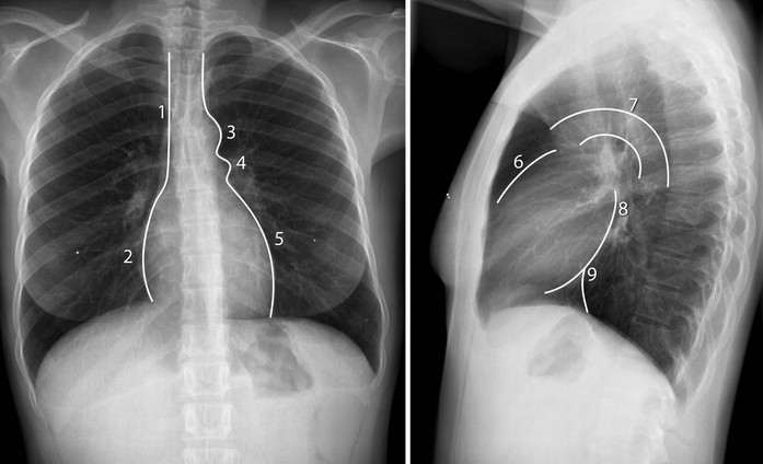 Cardiovascular radiology - Who are Radiologist Doctors?