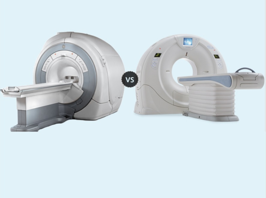 MRI Scan vs CT scan for Brain