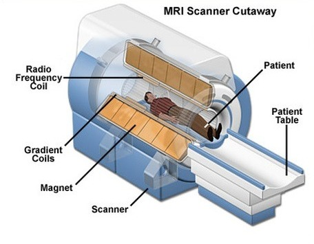 How MRI Scan works?