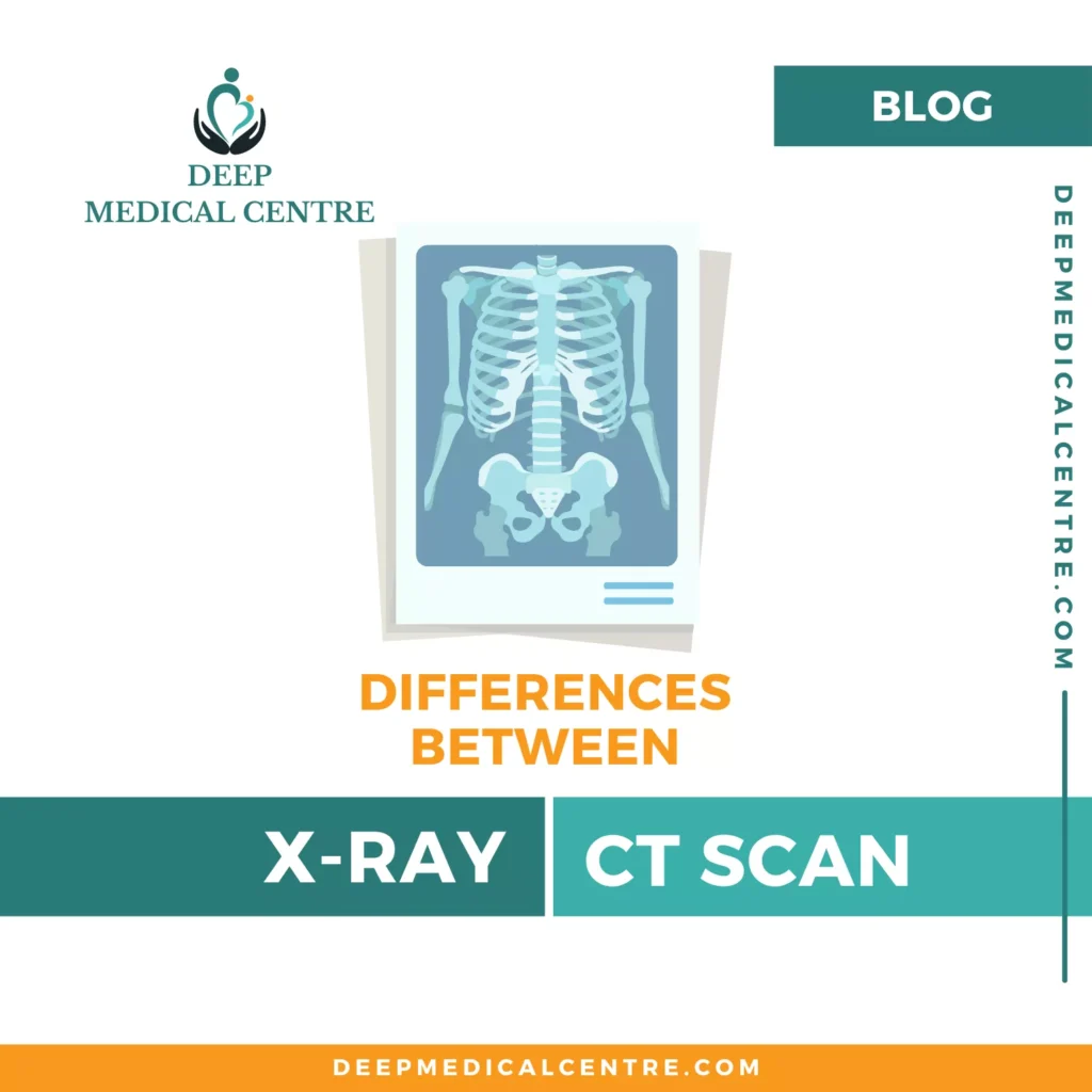 6 differences between X ray and CT scan