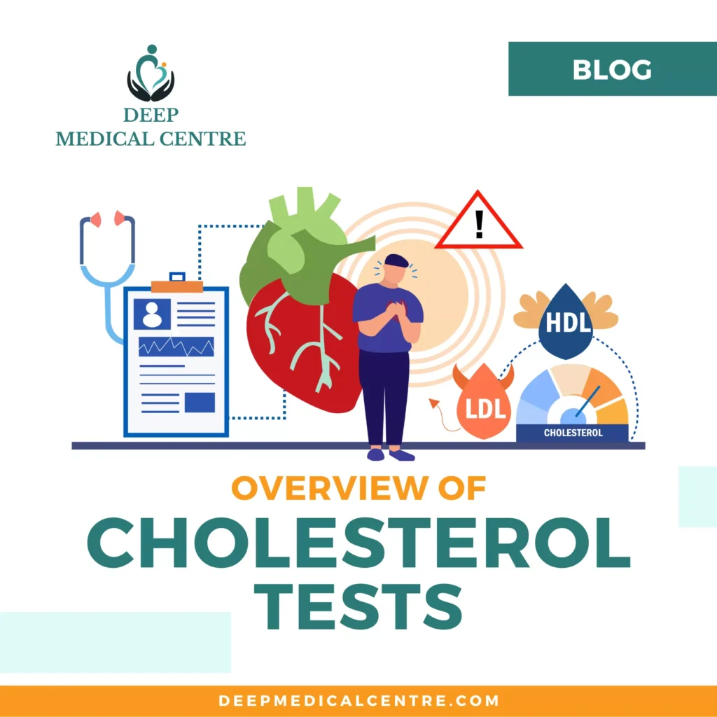 cholesterol tests