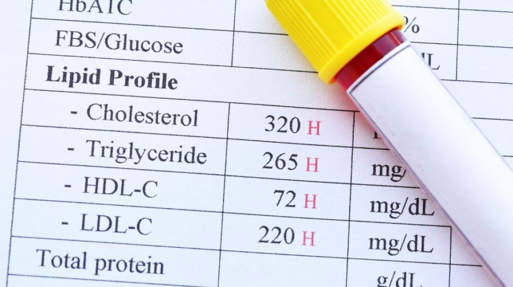 Understanding Cholesterol Tests: A Comprehensive Guide